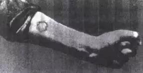 这种物质曾被当作保健成分,受害者的遗骨因此发光上千年