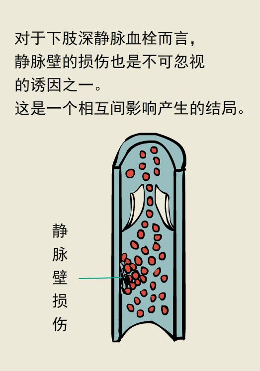 单腿肿和双腿肿的区别,两条腿肿的程度不一样