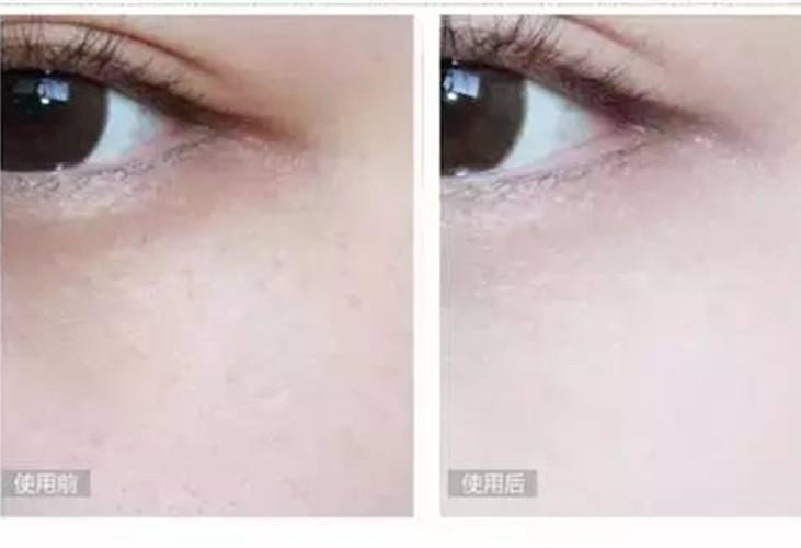 先涂防晒霜还是先涂bb霜,先涂防晒霜还是先涂bb霜正确