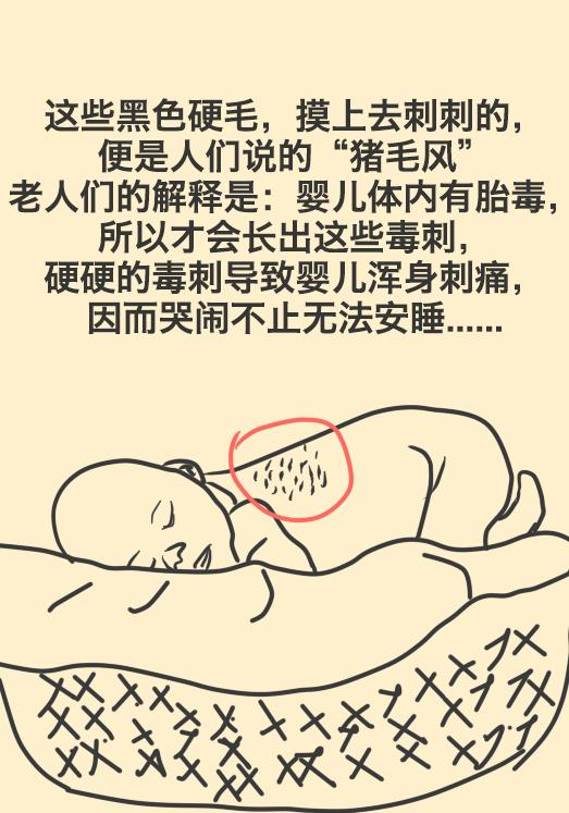猪毛风在医学上叫什么病,新生儿的猪毛风是什么