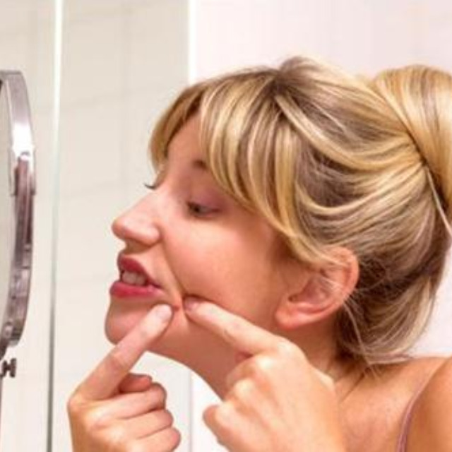 鼻子下巴闭口粉刺怎么去除,闭口粉刺护理全攻略