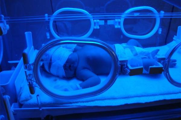 abo溶血性黄疸严重的话需要换血吗,新生儿黄疸400换血后会有什么反应