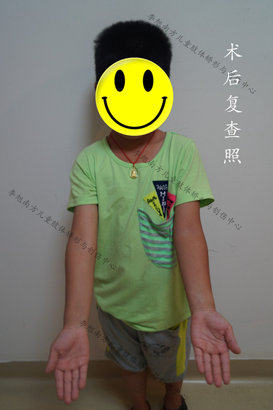 孩子胳膊摔伤后伸不直怎么办,小孩摔了跤胳膊伸不直是怎么回事