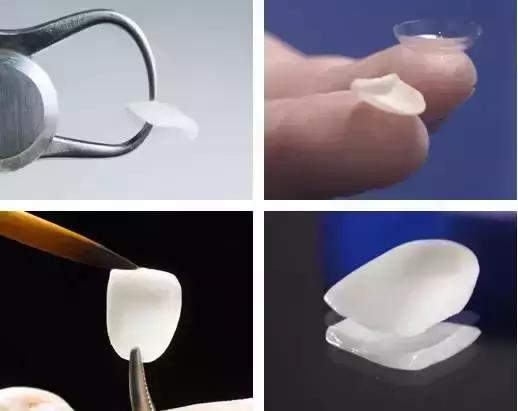 牙齿美白的必备干货,真正靠谱的牙齿美白方法