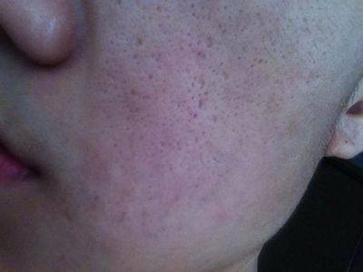 毛孔粗大不卡粉底妆技巧,痘印还有粗大毛孔怎么上妆不卡粉