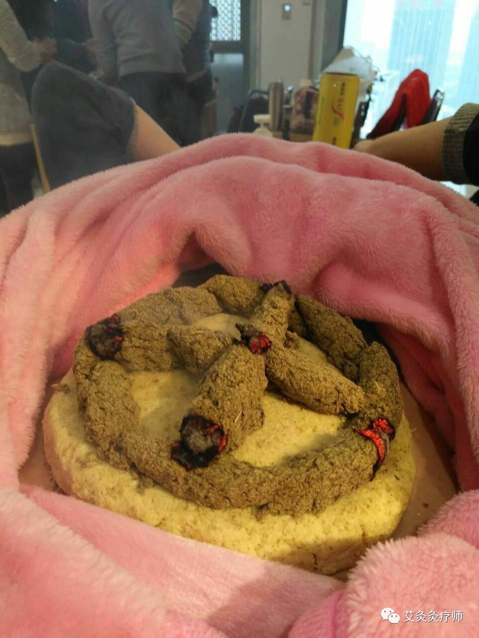 艾灸经络塑形,艾灸哪个穴位可以减内脏脂肪