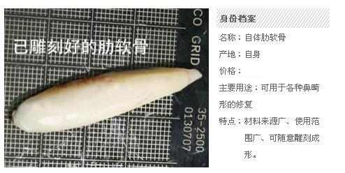 隆鼻价格一览表了解下不花冤枉钱,隆鼻价目表曝光及案例