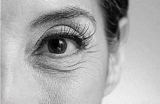 如何去除鱼尾纹的方法图解,鱼尾纹显老的方法