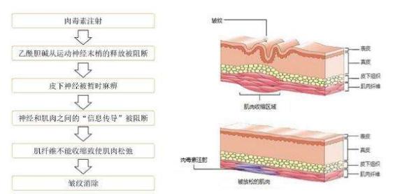 如何去除鱼尾纹的方法图解,鱼尾纹显老的方法