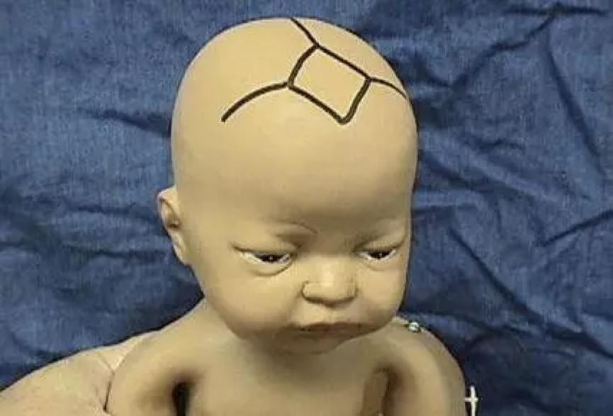 换季儿童感冒鼻塞食疗方法,冬天宝宝感冒鼻塞小妙招