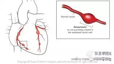 一岁宝宝会得川崎病了吗,9个月宝宝得了川崎病有影响吗