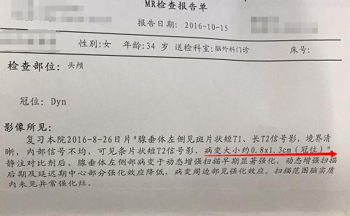 泌乳素垂体瘤中医怎么治疗,泌乳素型垂体瘤患者自述