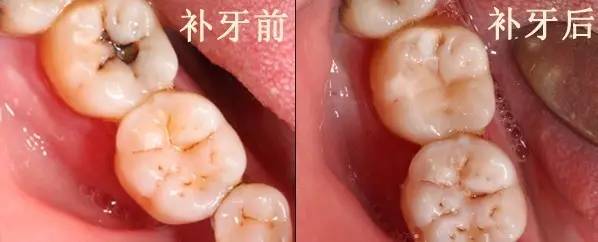 我们的牙齿是怎么来的,我们的牙齿是哪来的