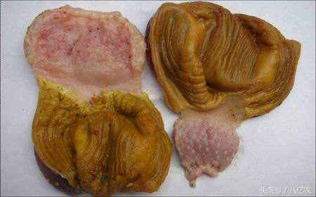 氟苯尼考可以治疗腺肌胃炎,鸡得了腺肌胃炎有什么症状