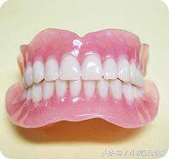 老年人镶牙的类型和价格,老年人镶牙选哪种好