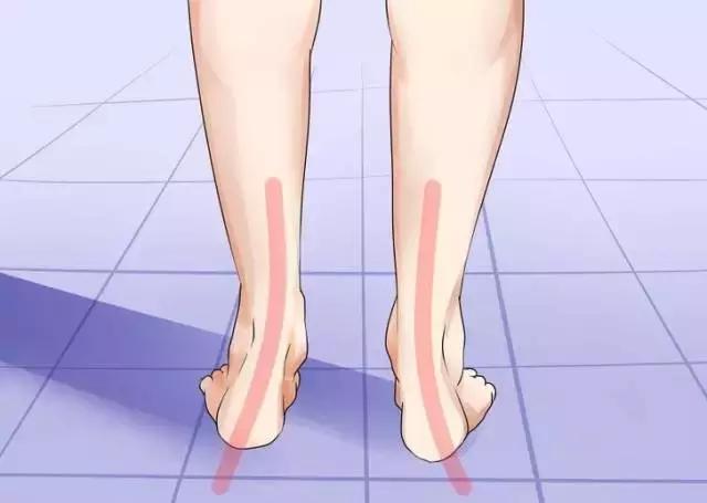 八字脚对跑步有影响吗,跑步时八字脚产生原因及纠正方法