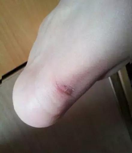 穿鞋正确方法,穿鞋妙招