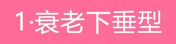 美女与野兽|天生法令纹只能靠整容吗?那是因为你没看这篇!