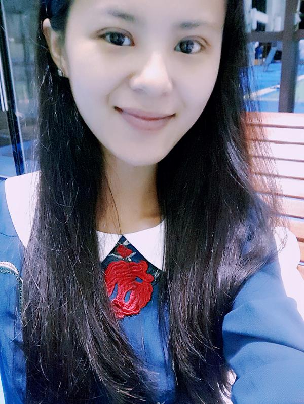 全切双眼皮15天,恢复的差不多了