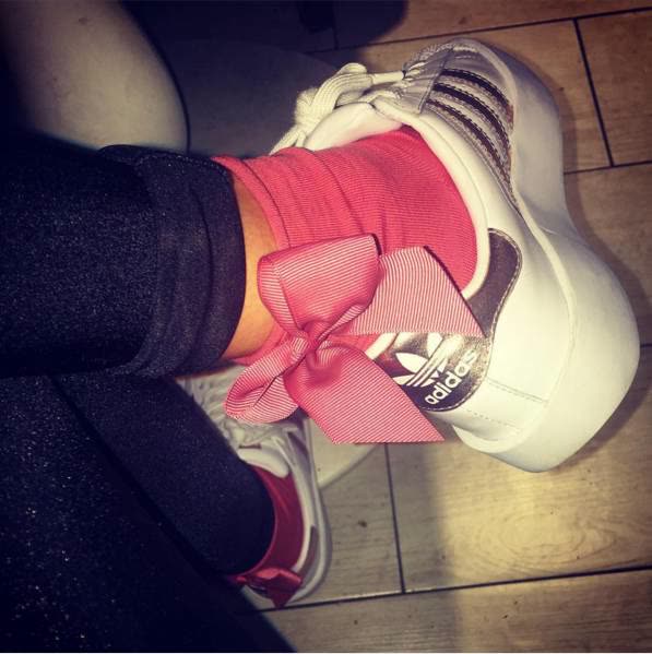 刘雯polo衫蝴蝶结,刘雯的时尚穿搭推荐