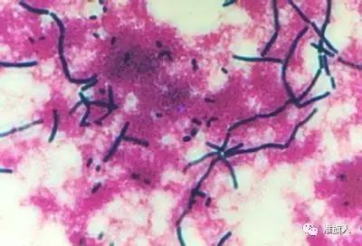 含酸的米饭,湖南酸米饭