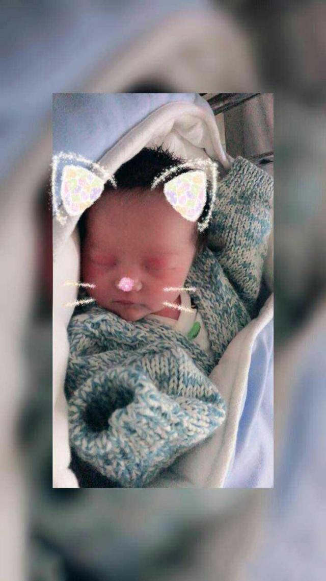 肥胖孕酮低，没打黄体酮也生康健女宝