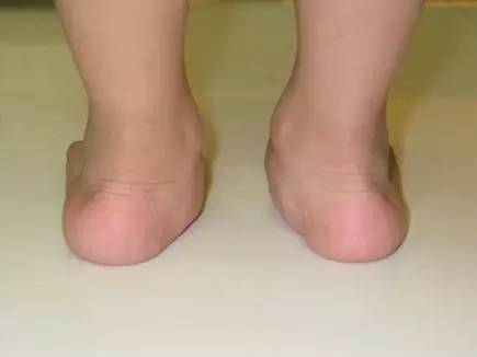 小腿结构图示图片,小腿骨骼构造示意图