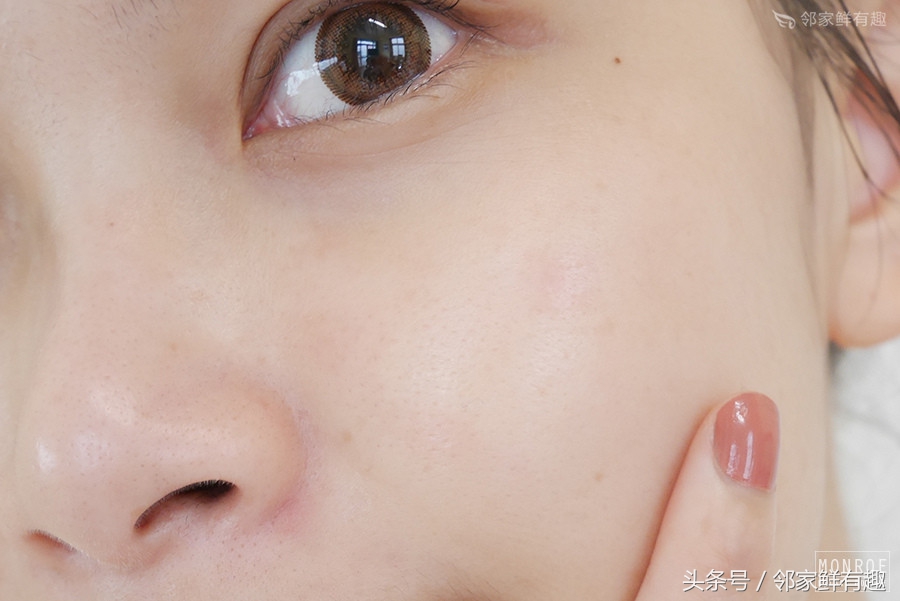 消除皮肤泛红,消除敏感肌角质层薄