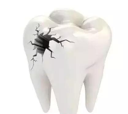 儿童7龄牙龋坏的最佳处理方案,7岁女孩牙齿都是坏的怎么办