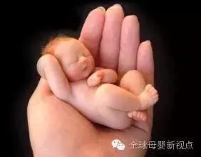 优生四项巨细胞病毒igg阳性,优生优育十项检查巨细胞病毒阳性