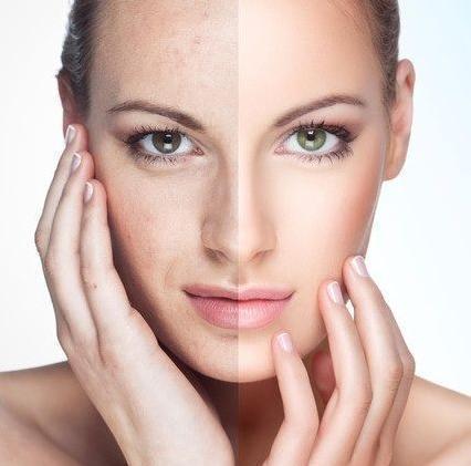 用什么在家做面膜最补水效果最好,在家用什么做面膜美白保湿去皱