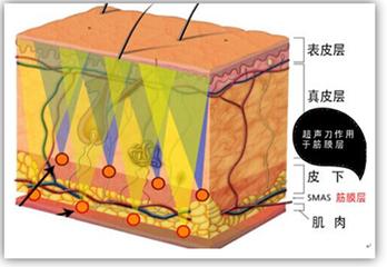 超声刀的危害与副作用,超声刀美容的副作用