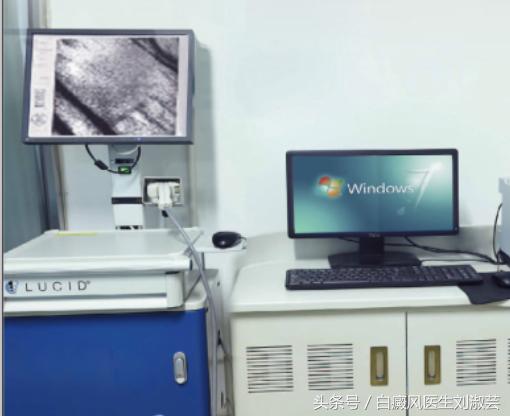 吃药吃到发吐,针头大的白癜风怎么治