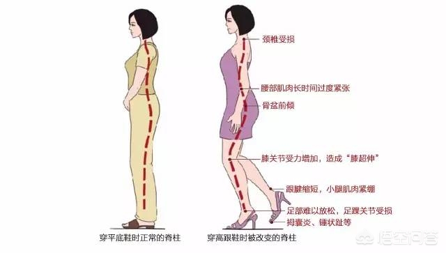 为什么腰痛会导致头晕,为什么腰痛脖子痛