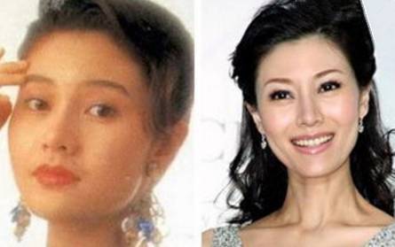 近几年流行的整容脸,千万别整容不要太在意自己的容貌