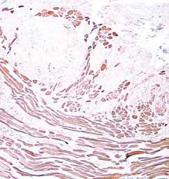 内镜做病理分析大概多久,作为一个医生太感性怎么办