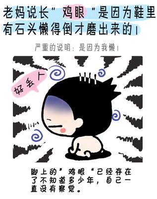 脚上长鸡眼有什么好办法去除,鸡眼是怎么形成的如何去除