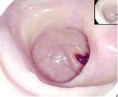 腹胀下肢浮肿怎么回事,不明原因的呕吐腹泻怎么回事