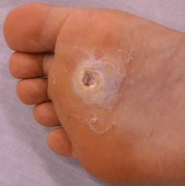 认识指甲死皮,认识足字旁