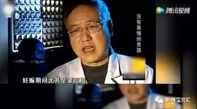 孕妇在下雨天生下怪胎,因劳累生出重疾宝宝