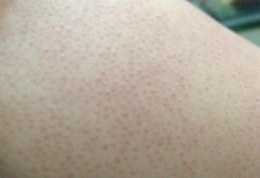 夏天露肉的季节到了刷出小蛮腰 (夏天到了又到了露肉的时候了)