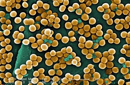 超级细菌抗生素研究进展,科学家对抗超级细菌的方法