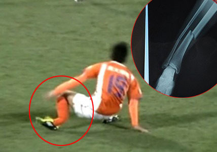 中国足球史上十大伤病,中国足球十大断腿阵容