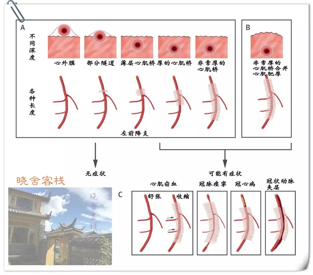 什么叫“挤奶现象”？这种病以前都没听说过，现在每天都有人来问