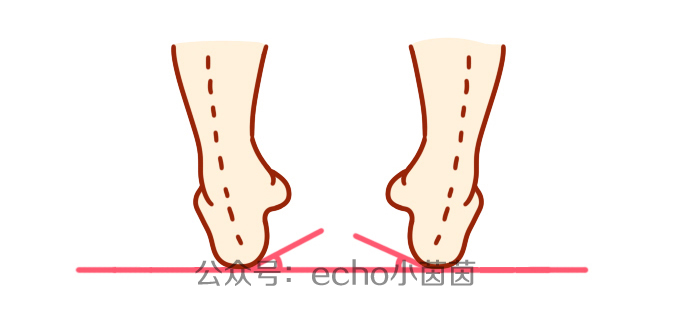 宝宝鞋底磨掉是什么原因,宝宝鞋底磨损滑怎么办教你一招
