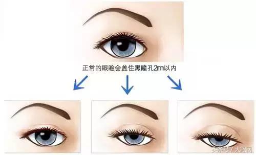 不用去医院的秘诀,妇科不出毛病的小妙招