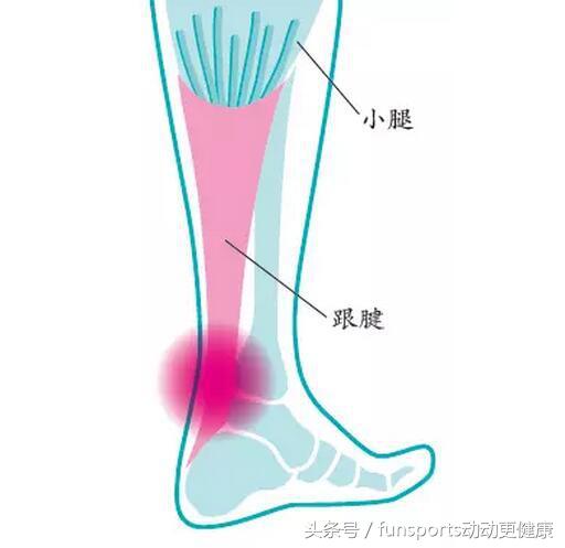 足球运动员跟腱长好不好,足球职业球员跟腱