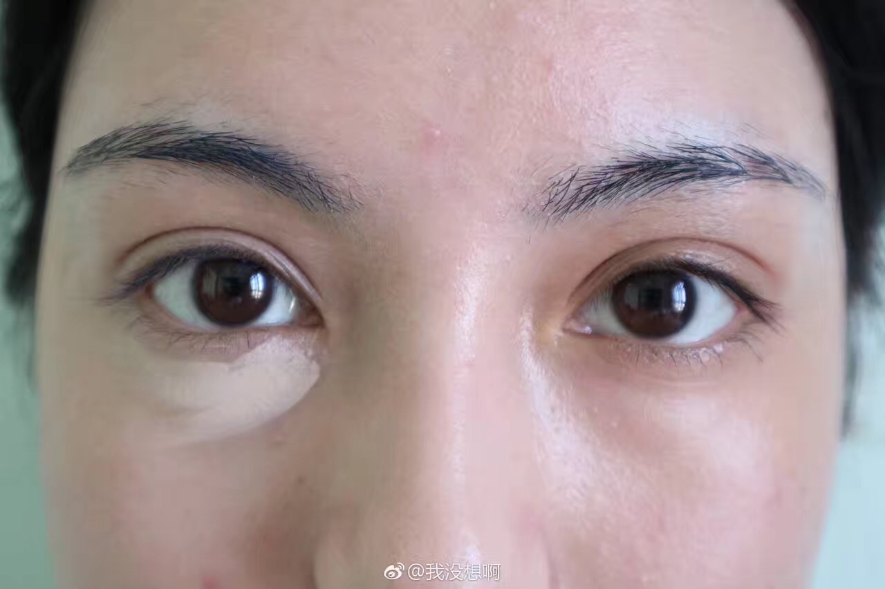 nars遮瑕蜜哪款遮瑕效果最好,nars哪一款遮瑕膏适合自己