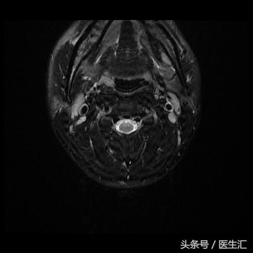 神经内科疾病诊断公式,神经系统疾病的诊断思路及步骤