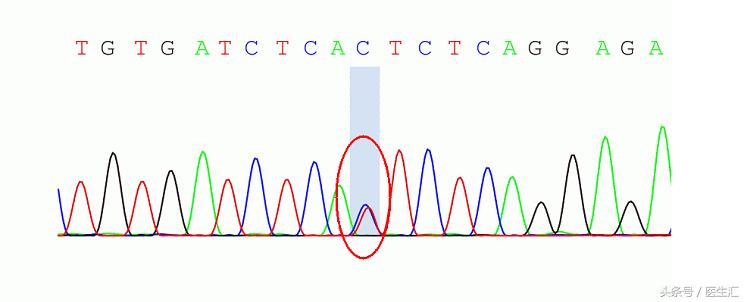 神经内科疾病诊断公式,神经系统疾病的诊断思路及步骤